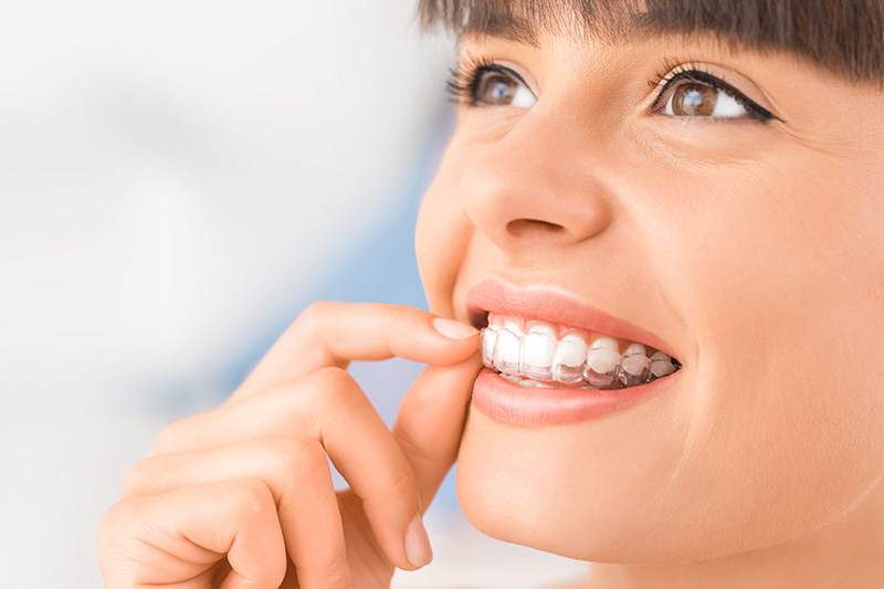 Super Smile Orthodontics Special Offer