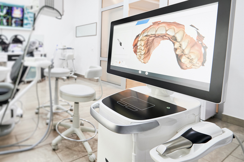iTero Intraoral Scanner in Corona