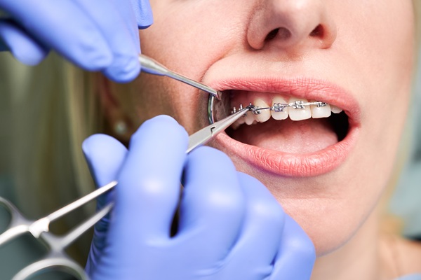 Braces Specialist: Your Path To Straighter Teeth